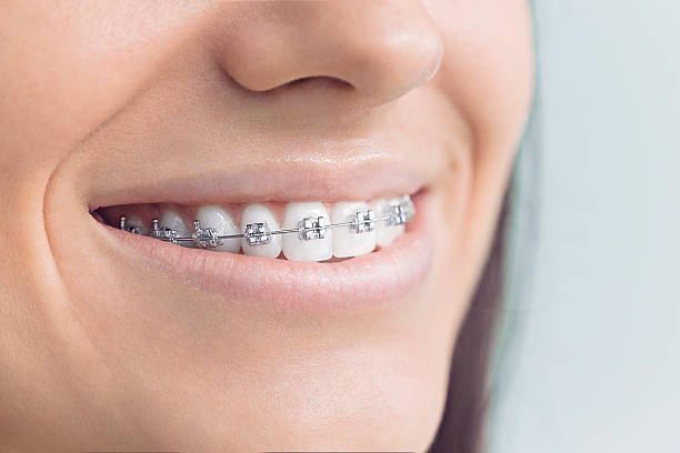 Best Dentures (Full and Partial)  in Fairfield Beach, OH
